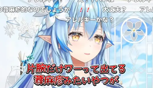 ラミィ、配信中に腕の“謎の赤いプツプツ”を発見→一気に病院案件へ　「アレルギーは突然に」「早く病院行って」